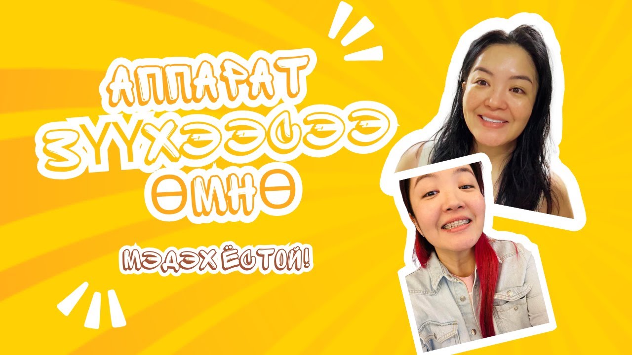 Шүдний Аппарат Зүүхээс Өмнө Мэдэх Ёстой Зүйлс! 😱🦷