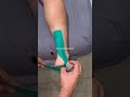 Plantar Fasciitis Taping Technique | Heel Pain Relief with Kinesio Tape 👣