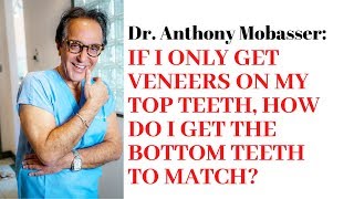 If I only get veneers on my top teeth, how do I get the bottom to match? | Dr. Anthony Mobasser
