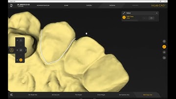 Bridge Workflow inLab CAD 22
