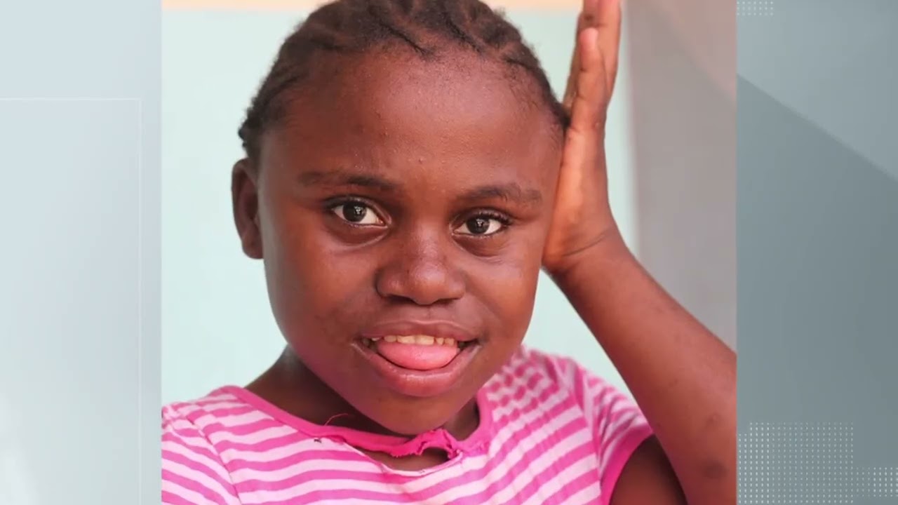 Crianças negras e com síndrome de Down sofrem preconceito duplo na infância