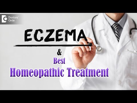 Eczema Causes: Symptoms & Homeopathic Management - Dr. Sanjay Panicker | Doctors&rsquo; Circle