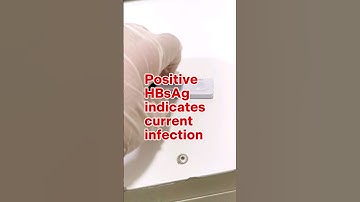 Hepatitis B Screening test #laboratory #medtechstudent #cls #mls #hepab