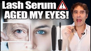 LASH SERUM⚠WARNING⚠!  EXPOSED for AGING YOUR EYES // Lash Conditioner may Be Aging Your Eyes
