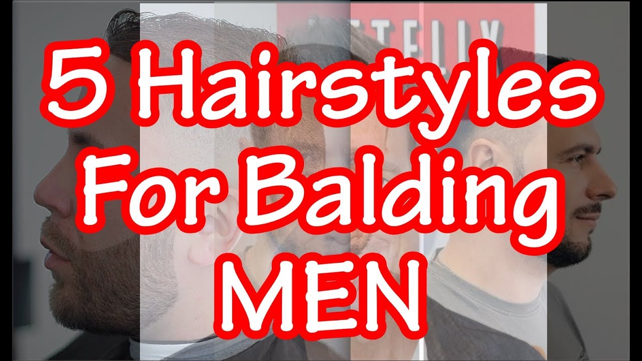 Hairstyles For Balding Crown • FACES Oman •