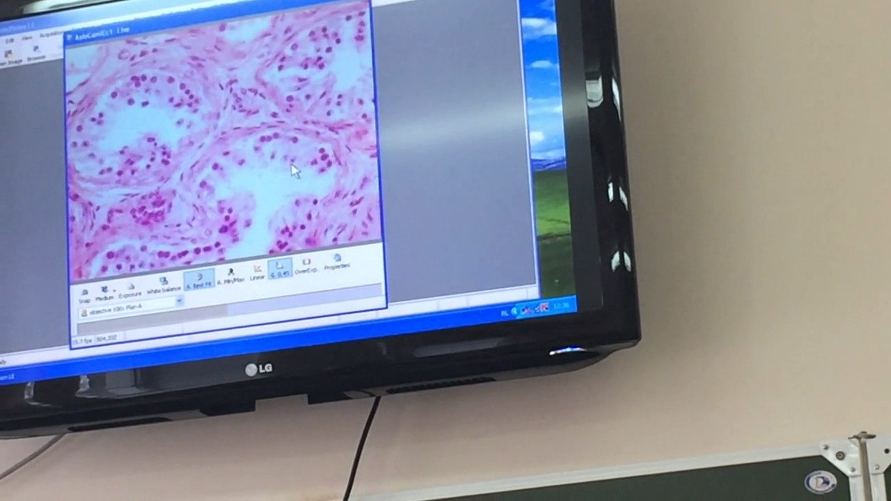 Гистология. Семенник (Мужская половая)