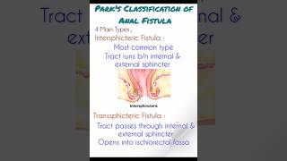 Anal Fistula Classification (Park's) 🩺 #aiims #jipmer #rrb #mrb #esic #all competitive exams 🩺