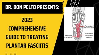 2023 Comprehensive Guide to Treating Plantar Fasciitis