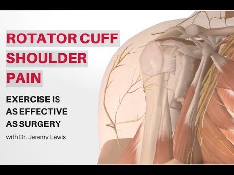 Video: Trenger supraspinatus-rivning kirurgi?