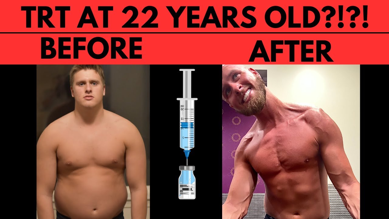Why I started TRT (Testosterone) at 22 Years Old - YouTube