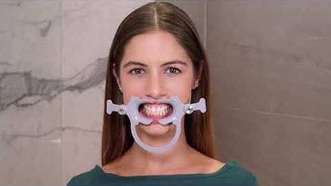 How to use Dental Monitoring