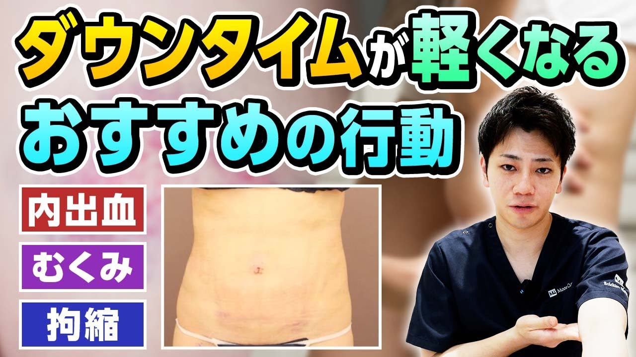 【術後の不安に】ダウンタイム中にオススメしたい行動 松元 宗一郎 医師 ｜ Mods Clinic モッズクリニック（脂肪吸引・注入）