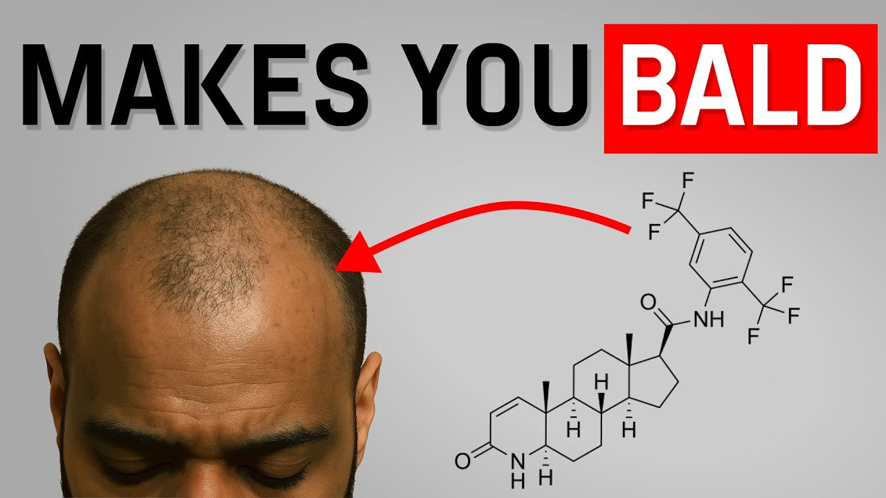 How Big Pharma Keeps Men Bald