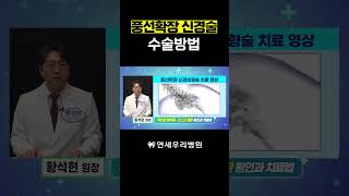 풍선확장 신경술의 수술방법은 무엇인가요?