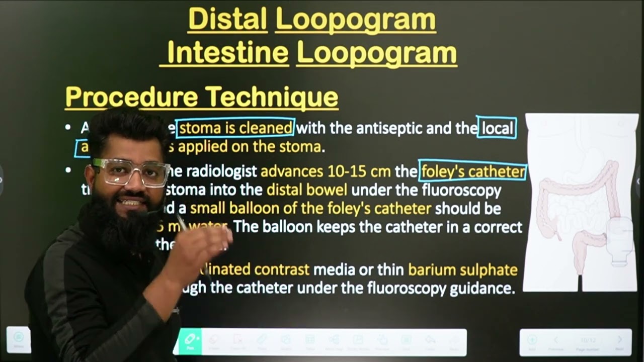 Loopogram Procedure || Distal Loopogram || Part-2 || In Hindi || intestinal Loopogram ||