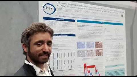 Yannick Le Bris shows that p16 overexpression or CDKN2A db del have worse prognosis in MCL