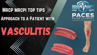 Approach to Vasculitis Cases: Diagnose & Manage Like a Pro | MRCP MRCPI TOP TIPS by Dr. Shaikh