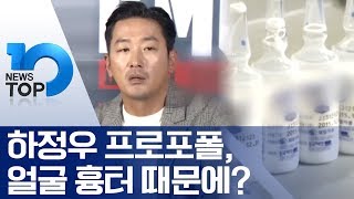 하정우 프로포폴, 얼굴 흉터 때문에?