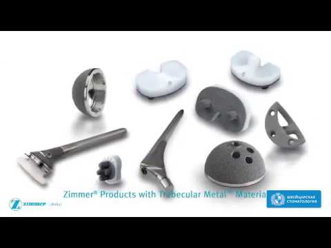 Технология трабекулярной имплантации Zimmer в медицине - смотреть видео