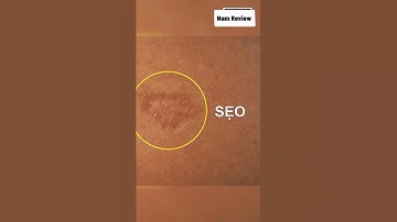 Tại sao phi công không được có sẹo trên người | Nam Review #shorts