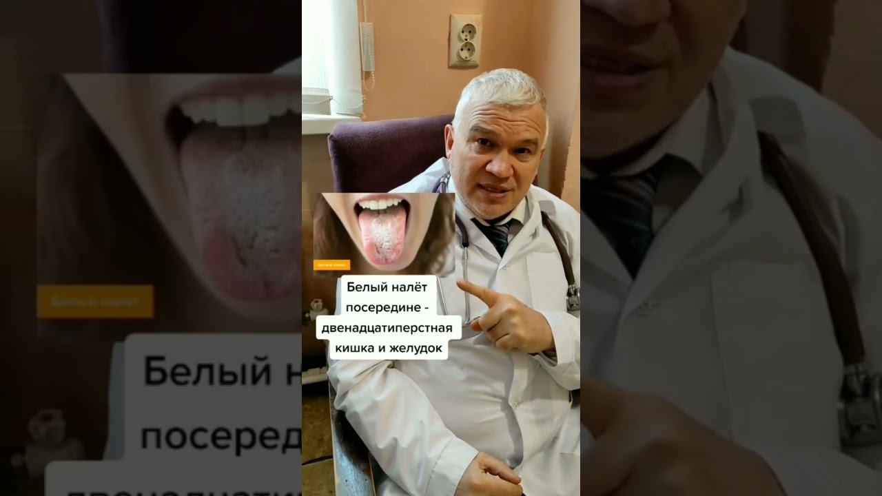 Диагностика по языку #диагностика #здоровье #язык