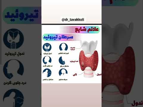 سرطان تیرویید علائم شایع سرطان تیرویید