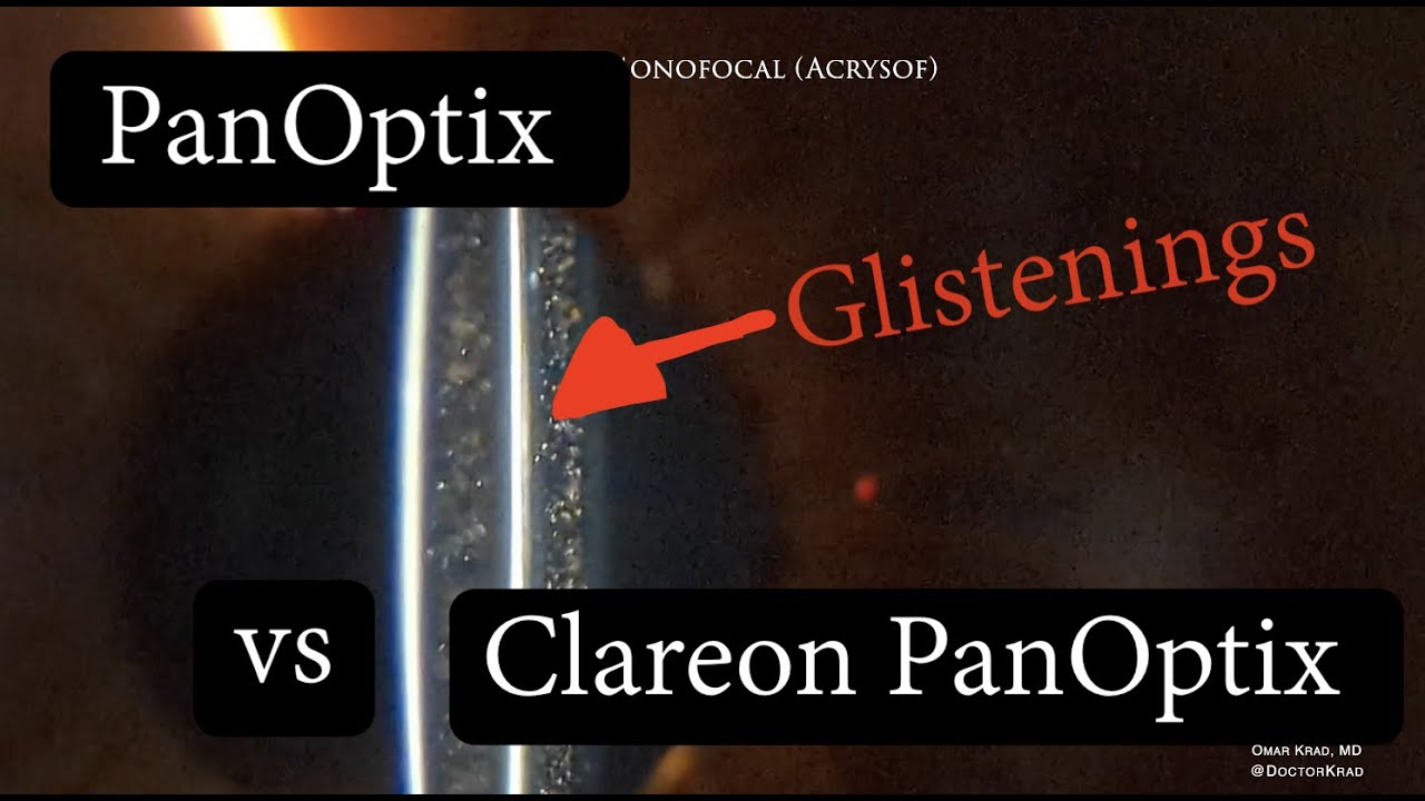 PANOPTIX vs CLAREON PANOPTIX. Difference in Glistenings? 