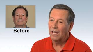 PAI Client Mike M. Discusses His Hair Transplant Results
