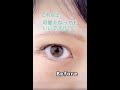 これ以上可愛くなってもいいですか?【二重整形】 #shorts