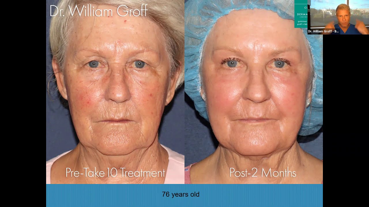 Banner for Dramatically Reduce The Signs Of Aging With The Take10 Treatment | Dr. William Groff