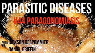 Parasitic Diseases Lectures #44: Paragonomiasis