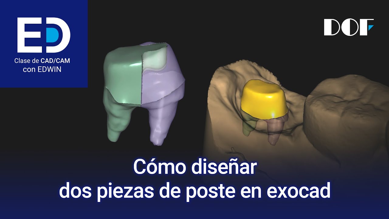 Cómo diseñar dos piezas de poste en exocad