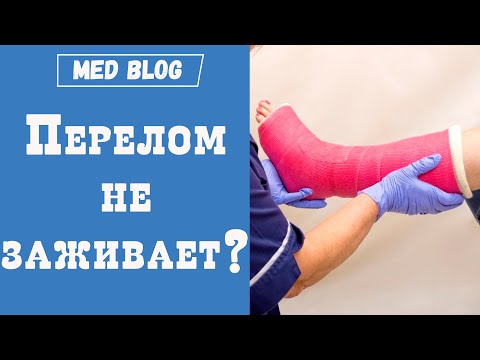 Почему не срастается перелом кости | Долго не заживает перелом кости | Что делать? | Причины