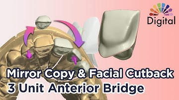 Digital Highlight - How To Mirror Copy & Facial Cutback On 3 Unit Anterior Bridge