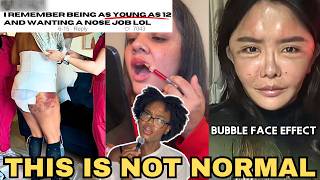 Why Gen Z Has A Plastic Surgery Problem