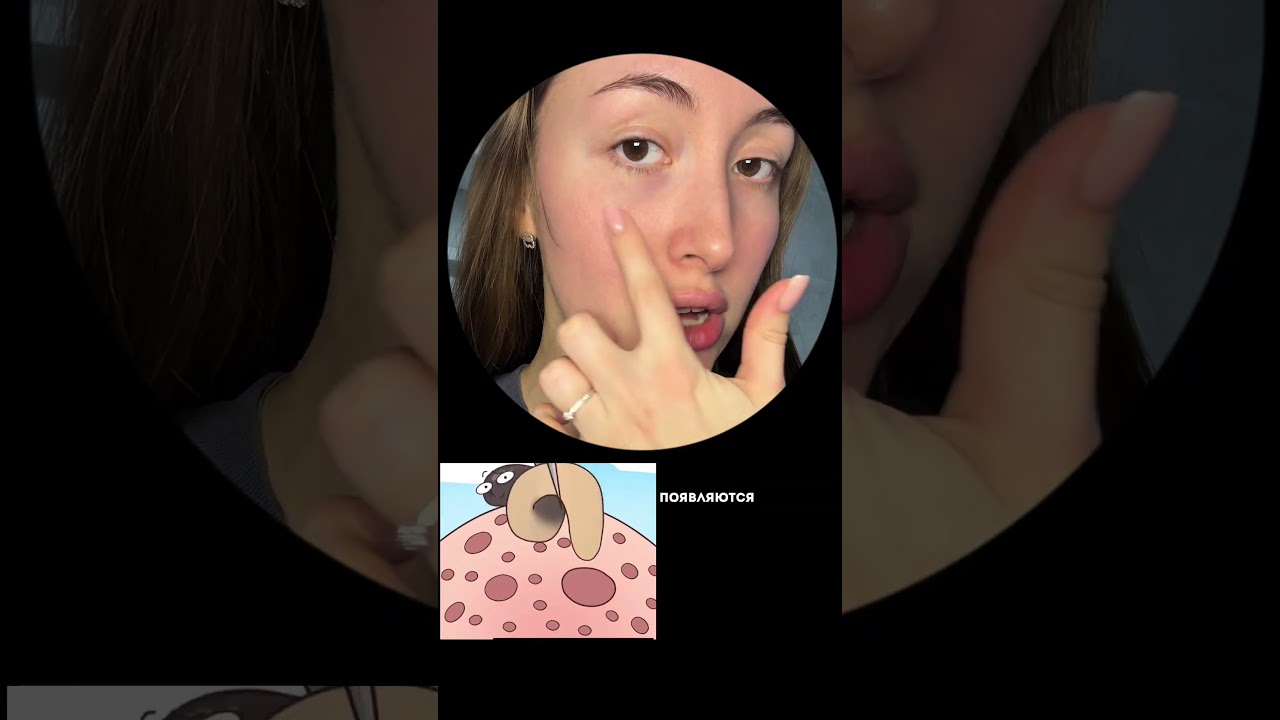 Сыворотка на вб - 