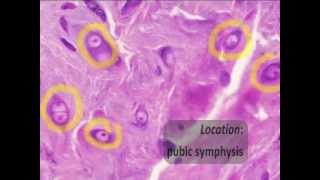Connective Tissue Part 3 Histology