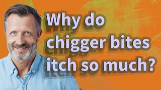 Why do chigger bites itch so much