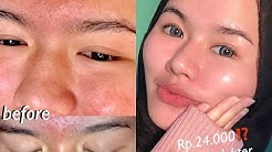 BRUNTUSAN? HILANG SEMALAM AJA! ðŸ˜³ [ #Pengalamanku sharing & SkinCare Updated Nabilrach ]  - Durasi: 14.16. 