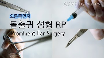 ASMR 돌출귀 Ear Surgery (Right Ear First)