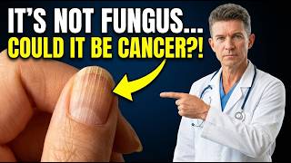 Look at Your Nails RIGHT NOW — 7 Signs of a Deadly Disease You Keep Ignoring