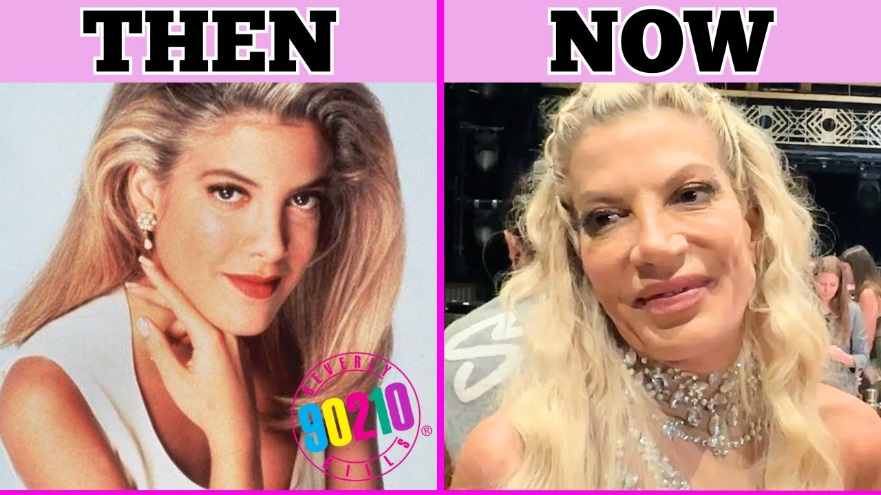 BEVERLY HILLS 90210: THE BEFORE AND AFTER OF THE CAST THAT NO ONE WAS READY TO SEE