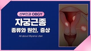 [산부인과] 자궁근종, 원인과 증상