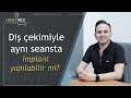 Diş Çekimiyle Aynı Seansta İmplant Yapılabilir mi?