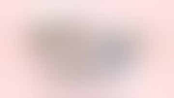 Laparoscopic CBD Exploration #laparoscopysurgery #choledocholithiasis #cholecystitis