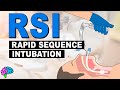 RSI and Intubation Techniques Quiz