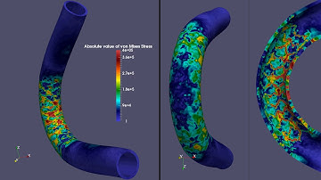 Finite element simulation of stent