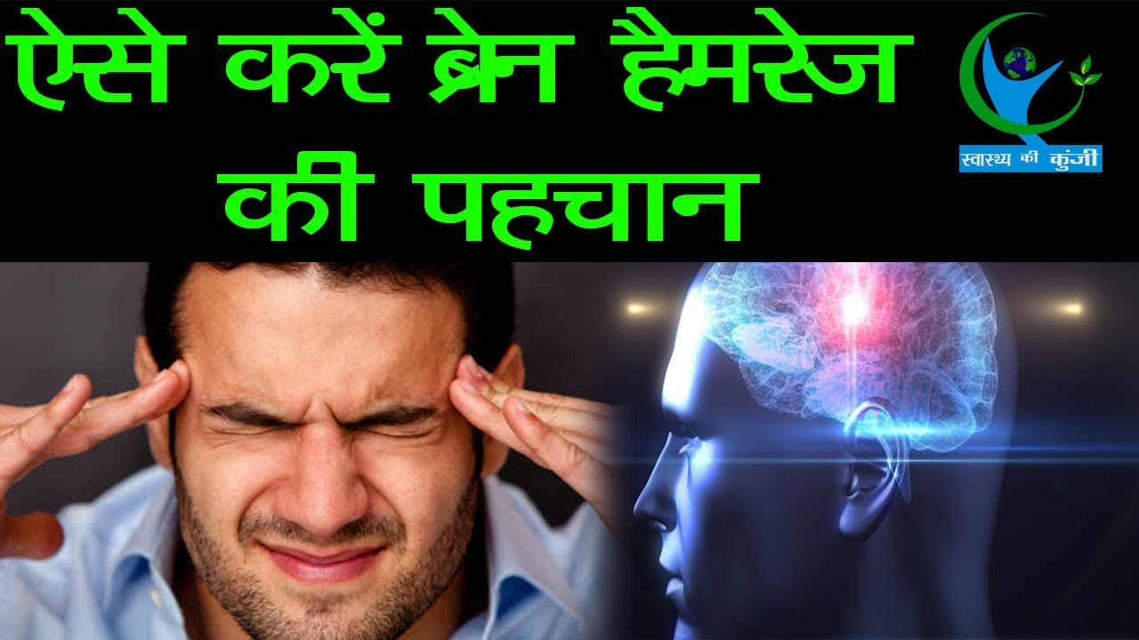  Brain 