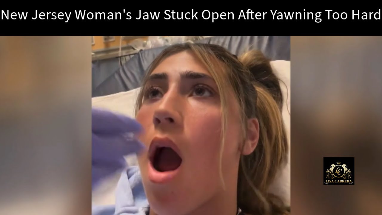 New Jersey Woman's Jaw Stuck Open After Yawning Too Hard YouTube