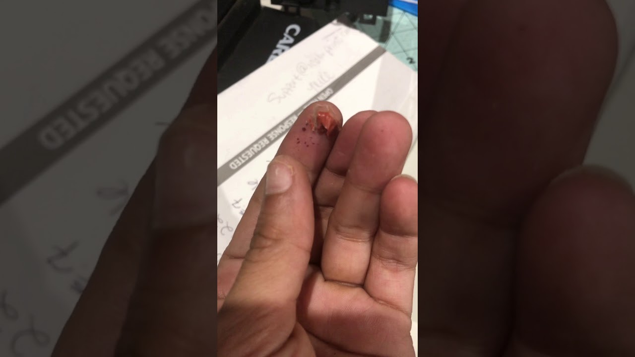 White toner technical difficulties SC542-00 and sc 500-00 error on Uninet i550 never buy used!